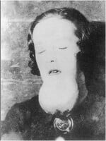 „Živá kostra“ a žena, která žila 25 let v místnosti se svými výkaly. 10 fotografií z historie, které dodnes děsí lidstvo