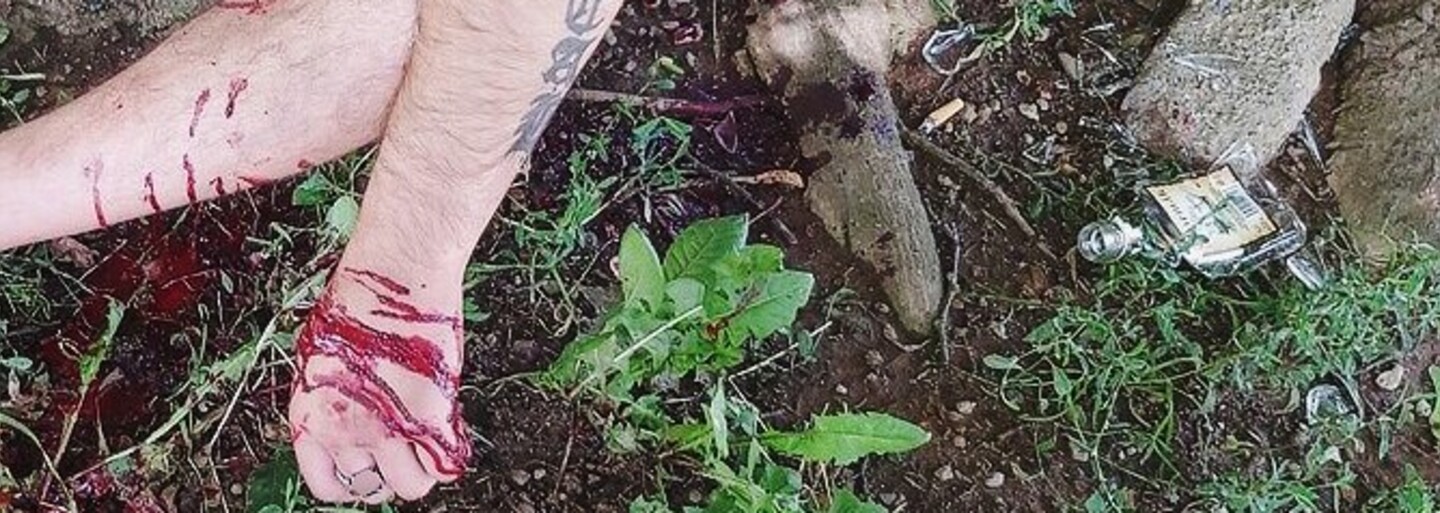 „Když jsi drsnej ACAB frajer a pak tě bastardi zachraňují.“ Pardubická policie komentovala zásah u pořezaného odpůrce
