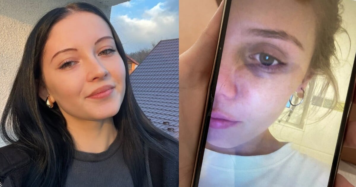 Mladé ženy si s námi promluvily o toxických vztazích: Měl nepředvídatelné výbuchy hněvu, věřila jsem, že je to moje chyba