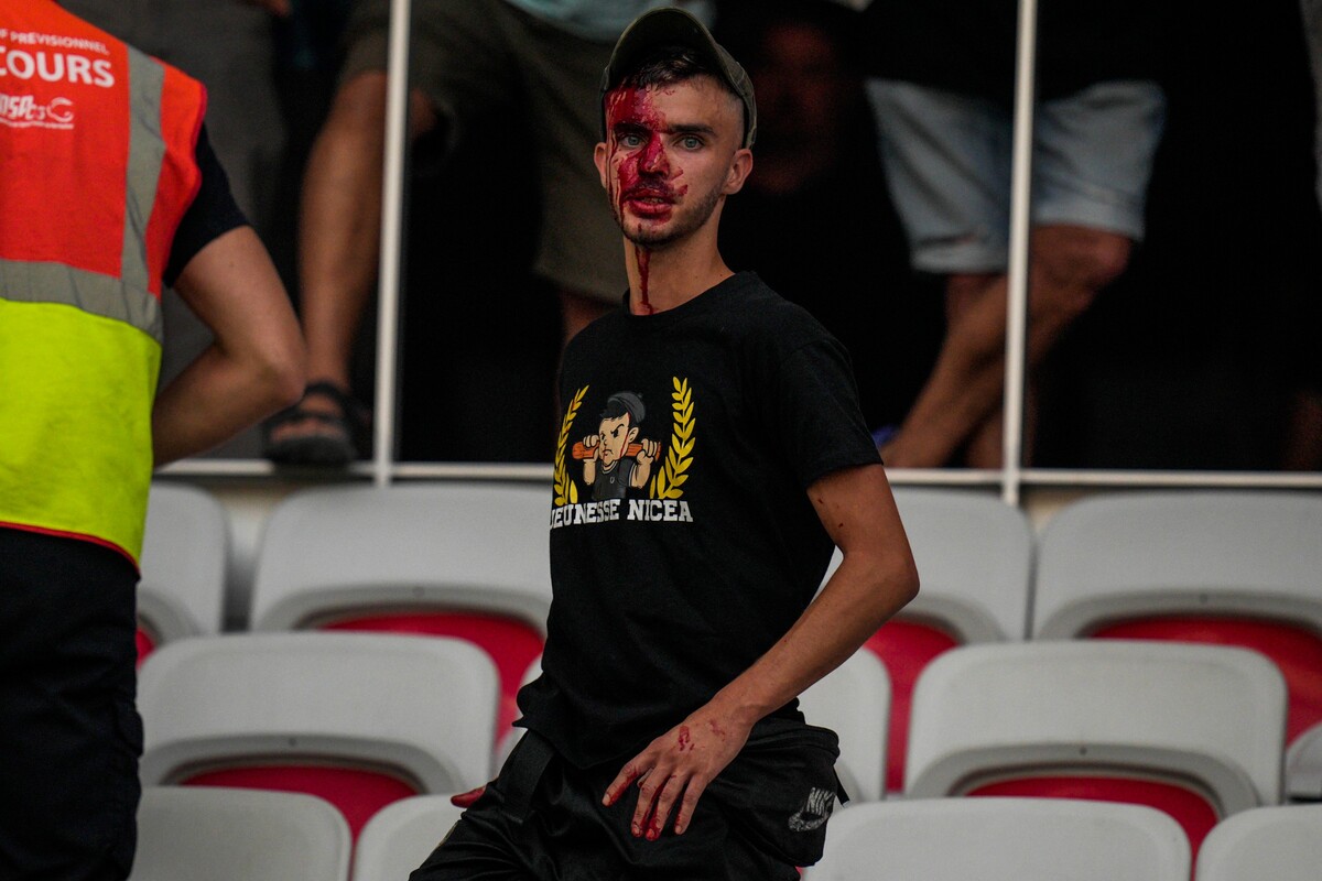 Zakrvavený fanúšik Nice po bitke s fanúšikmi Kolína na štadióne pred zápasom EKL vo futbale OGC Nice – 1. FC Kolín. Pre výtržnosti štart zápasu odložili z pôvodného času 18.45 na 19.40.