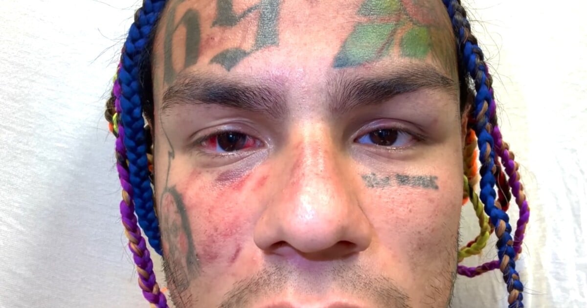 Tekashi 6ix9ine se vyjádřil k brutálnímu útoku: Bylo to zbabělé, ale na ulici neexistují žádná pravidla. Vydal také píseň s klipem