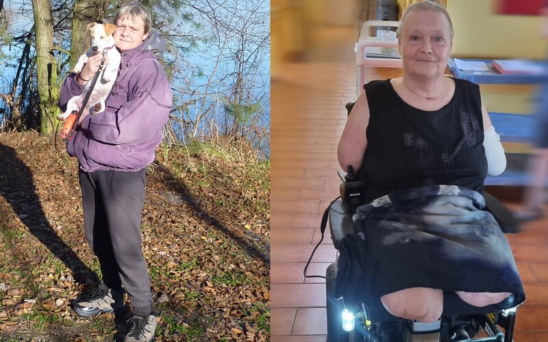 Po covidu přišla o ruce i nohy, 65letá Eva se však nevzdává. Pomoz jí znovu chodit.