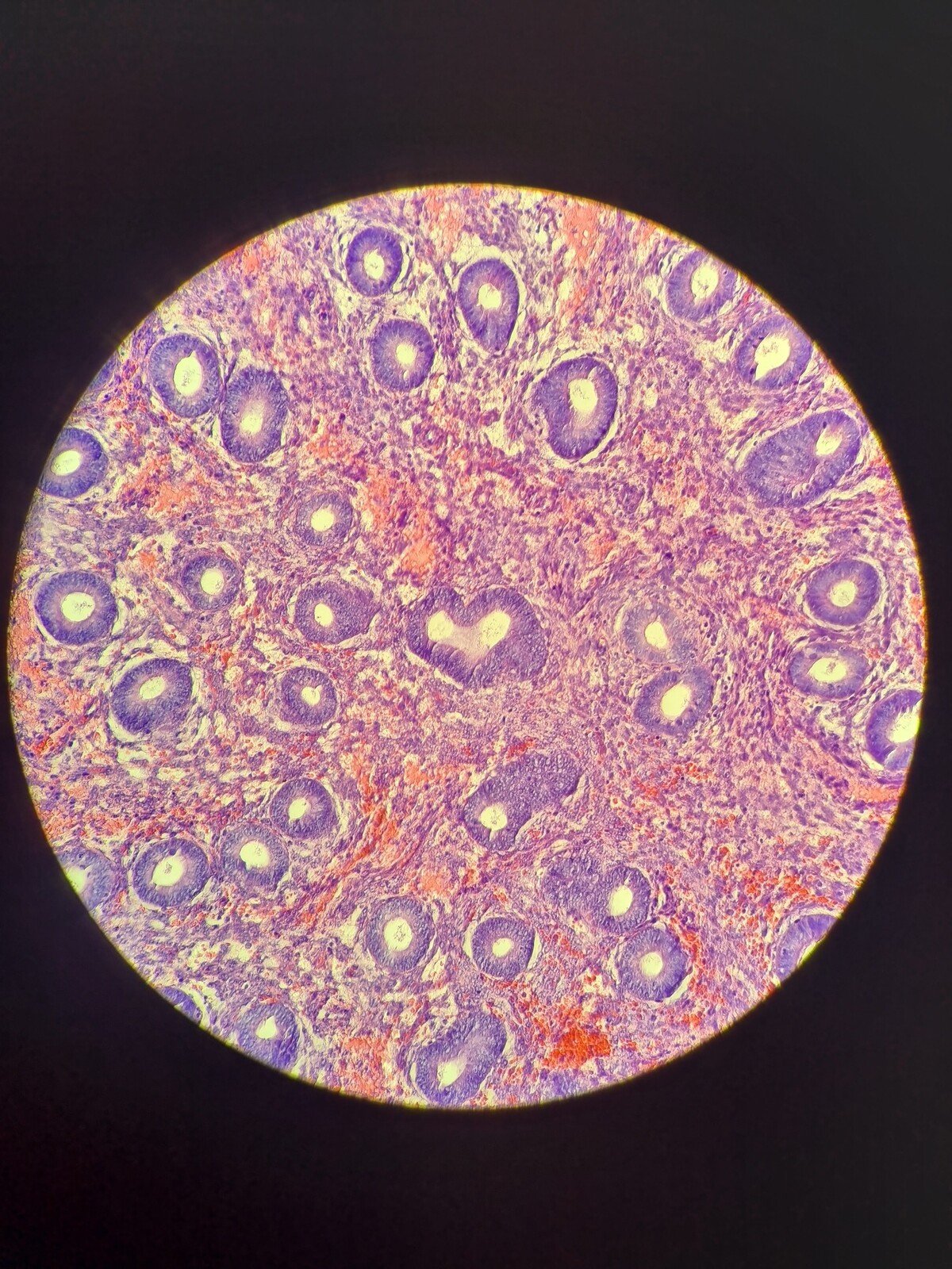 Mikroskopické endometrium.