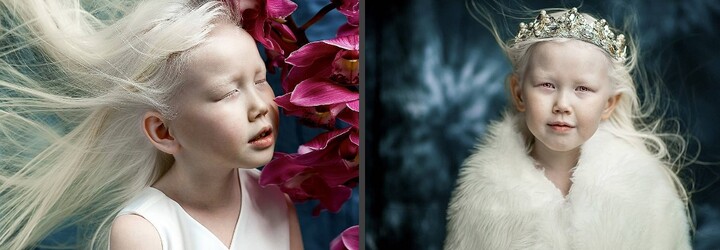 Krásná albínská dívka dostává nabídky do modelingu jako na běžícím pásu. Nariyana má jen 8 let a vypadá jako Sněhurka