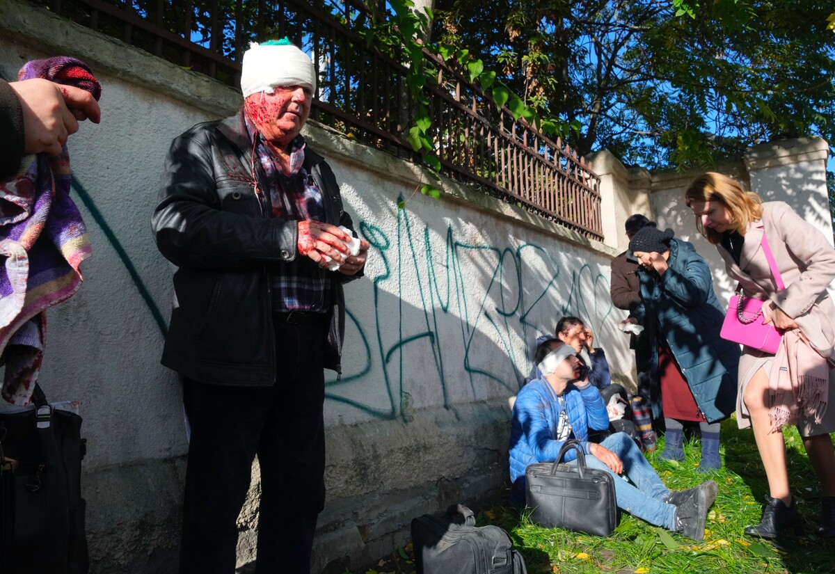 Na snímke zranení ľudia počas lekárskeho ošetrenia po ruskom ostreľovaní v Kyjeve 10. októbra 2022.