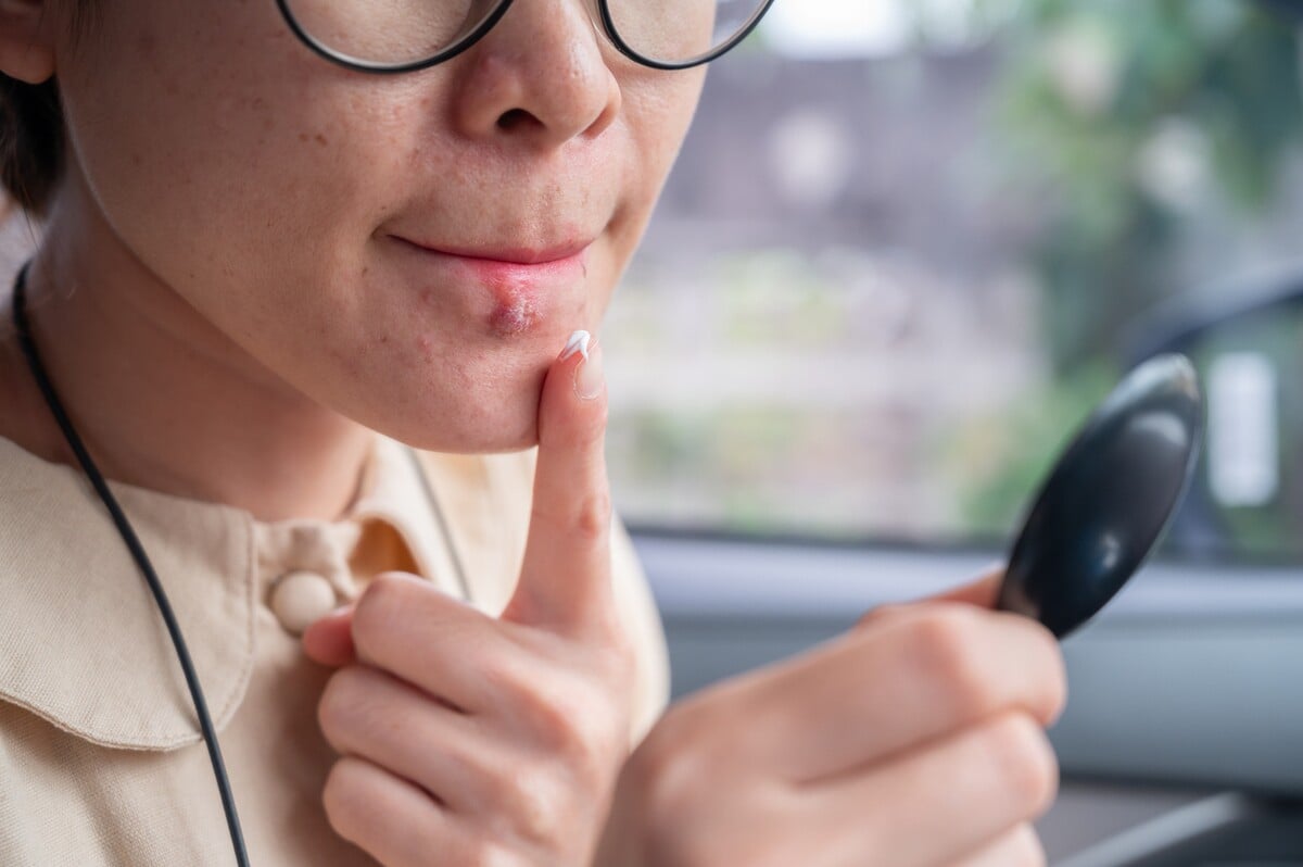 Syfilis sa môže u ľudí prejaviť v troch štádiách. Včasná diagnostika a liečba sú veľmi dôležité.