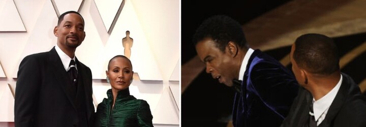 Co je alopecie? Will Smith udeřil Chrise Rocka za vtip o nemoci manželky Jady, která vypadávání vlasů proměnila ve svou přednost