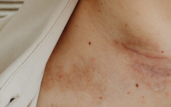 14-ročné dievča z Gelnice znásilnil spolužiak zo školy. Po vyučovaní sa vlámal do jej domu