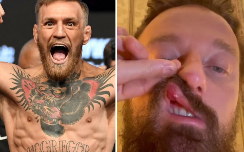 McGregor napadl v Římě známého DJe. Ten tvrdí, že to bylo úplně bezdůvodné, a hvězdu UFC chce žalovat.