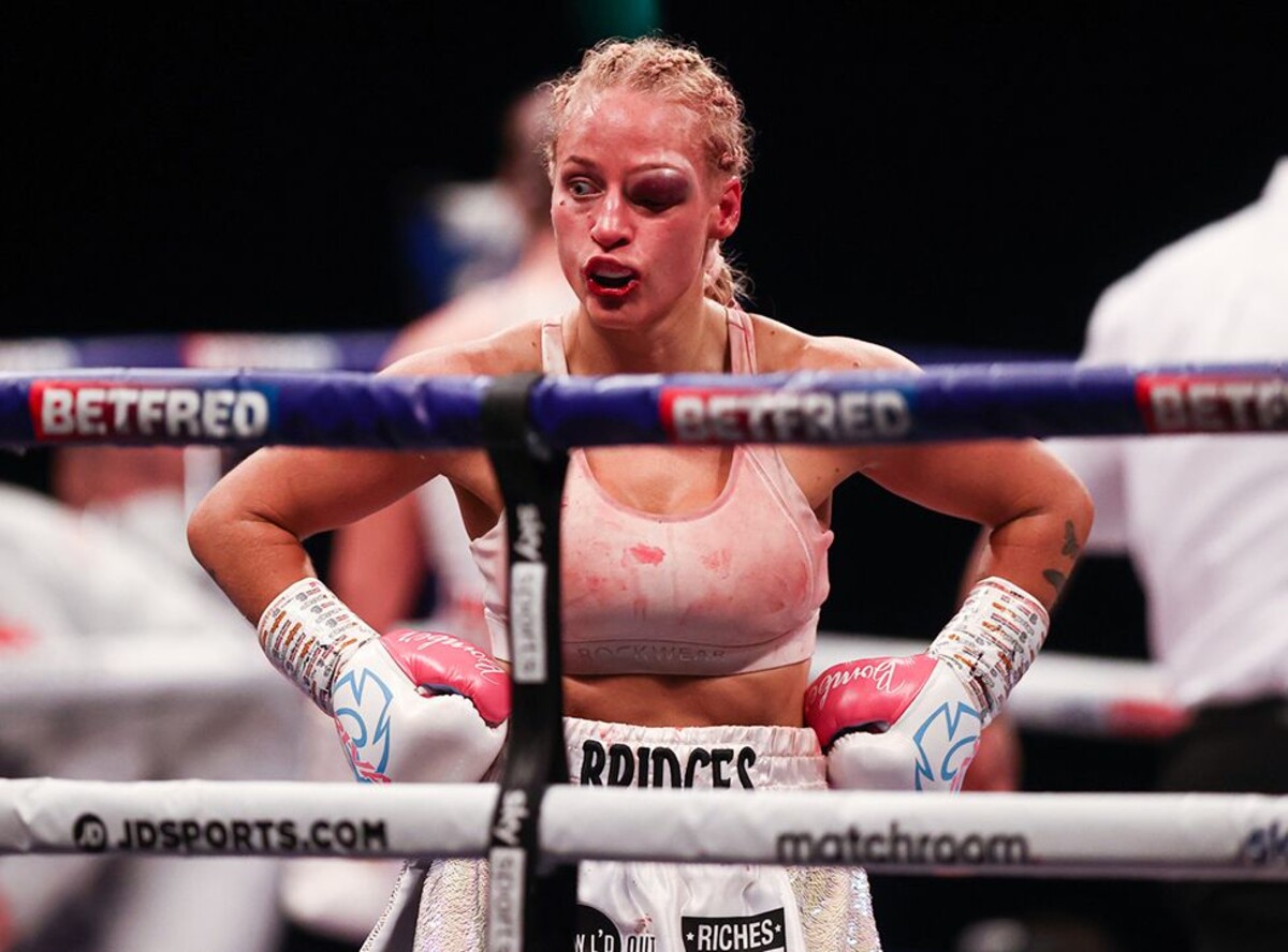 Kategorie: Box.
Ebanie Bridges z Austrálie utrpěla strašlivé zranění oka během zápasu organizace WBA v Londýně proti Shannon Courtenay z Velké Británie. 