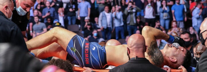 VIDEO: Hrozivé zranění na turnaji UFC. Bojovník si jedním kopem zlomil holenní i lýtkovou kost