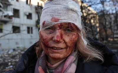 20 najsilnejších fotiek z ruskej invázie na Ukrajinu
