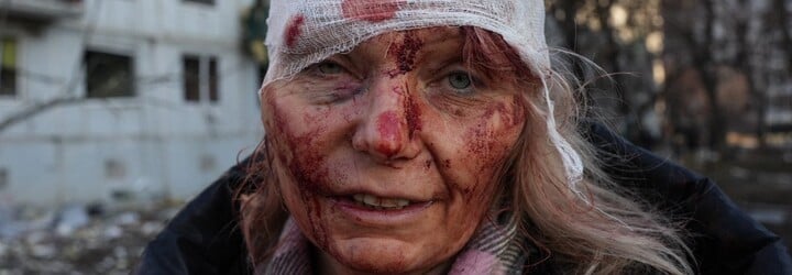 20 nejsilnějších fotek z ruské invaze na Ukrajinu 