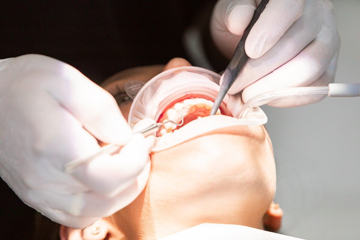 zubár, stomatológia