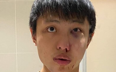 23letého Singapuřana zbili do krve: „Tvůj koronavirus v naší zemi nechceme!“ 23letého Singapuřana zbili do krve: „Tvůj koronavirus v naší zemi nechceme!“