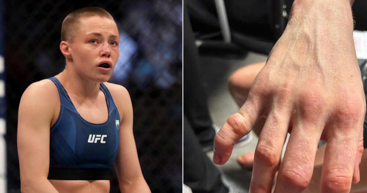 Hrozivé zranění v UFC! Bojovnice si zlomila prst, rvala se ale až do konce zápasu