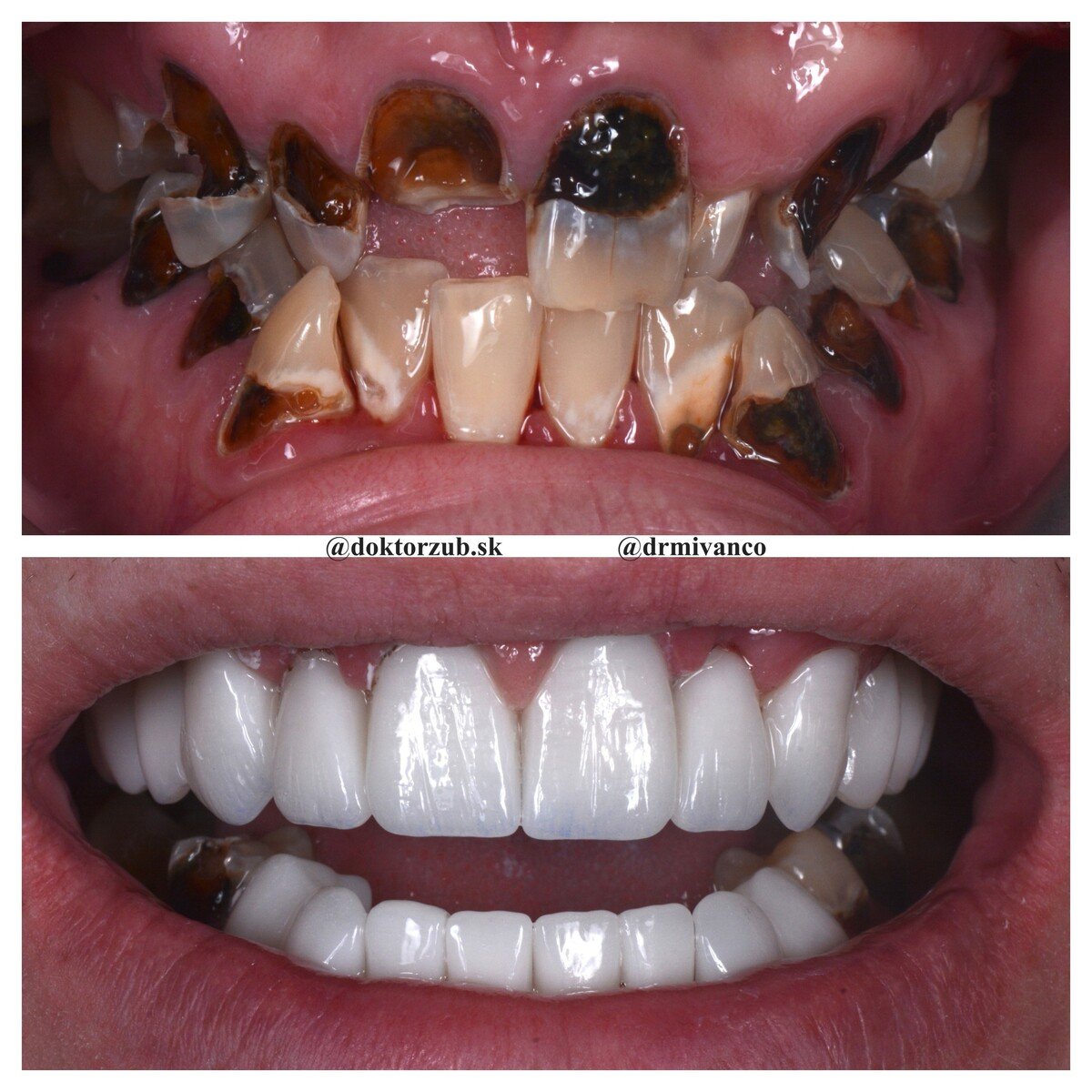 Doktor Zub , zubná klinika, zuby 