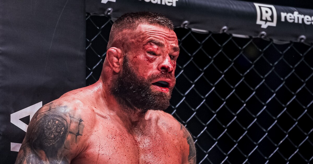 Foto: Takto vypadal obličej Karlose Vémoly po bitvě se šampionem Kinclem