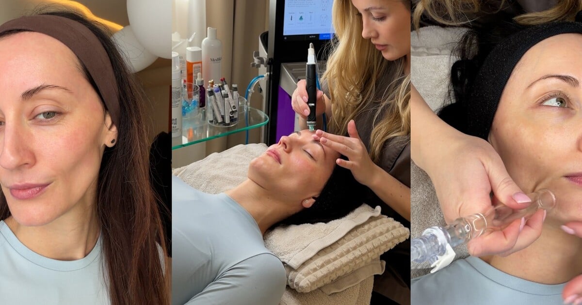Vyzkoušela jsem HydraFacial: Tohle ošetření ti pleť doslova „vysaje“ do dokonalosti