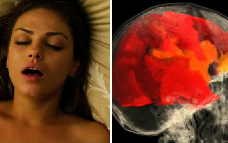 Takto vyzerá ženský mozog pri orgazme: Rozkoš zablokovala bolesť u žien s poškodenou miechou, ktoré prvýkrát od nehody vyvrcholili.