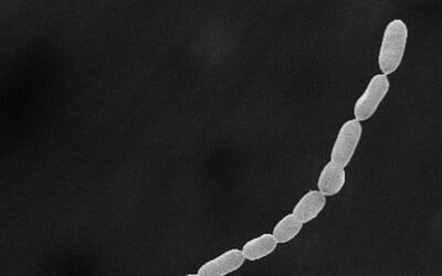 Vedci našli najväčšiu baktériu na svete. Meria až dva centimetre a uvidíte ju voľným okom.