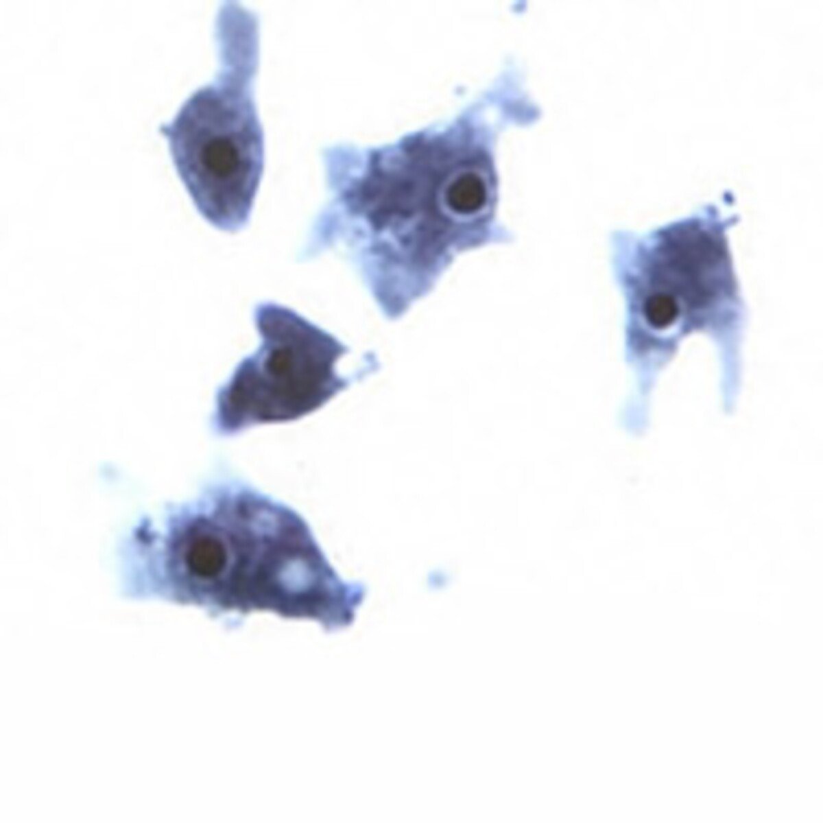 Naeglerie fowleri