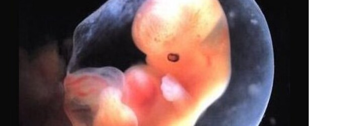 Vědci zkřížili člověka s ovcí. Bizarní embryo má přinést obrovský medicínský pokrok