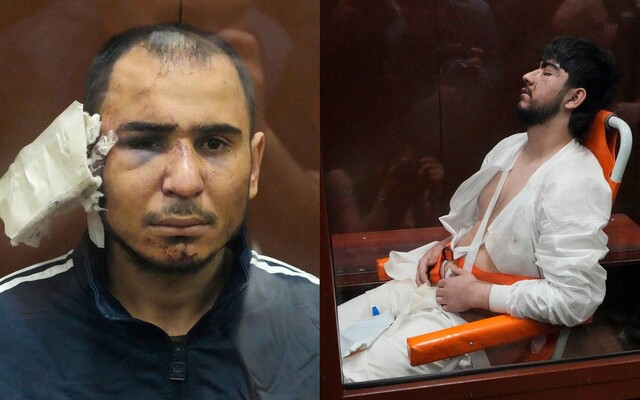 FOTO: Obvinených z teroristického útoku v Moskve mučili. Na genitálie im prikladali drôty a jednému vraj odrezali ucho