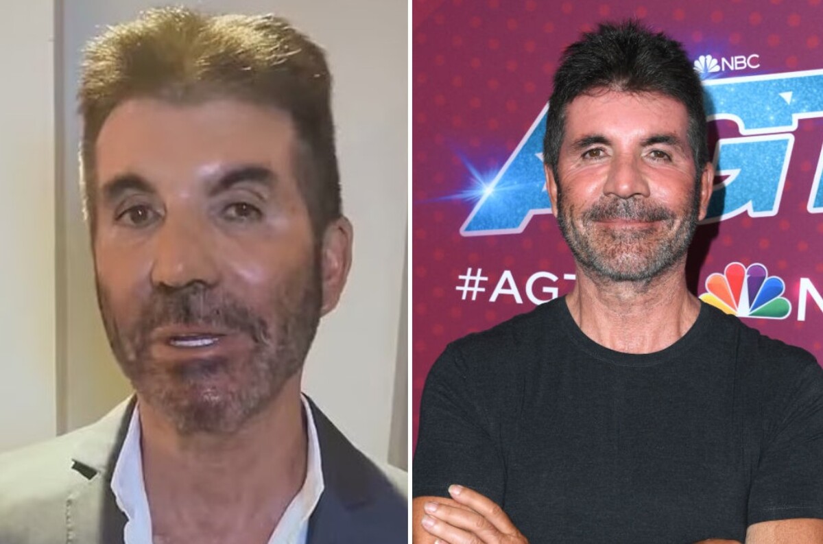 Vľavo z virálneho videa z Britain’s Got Talent v roku 2018, v ktorom ho fanúšikovia nespoznali. Zrejme bol krátko po facelifte. Vpravo fotka z leta 2022.