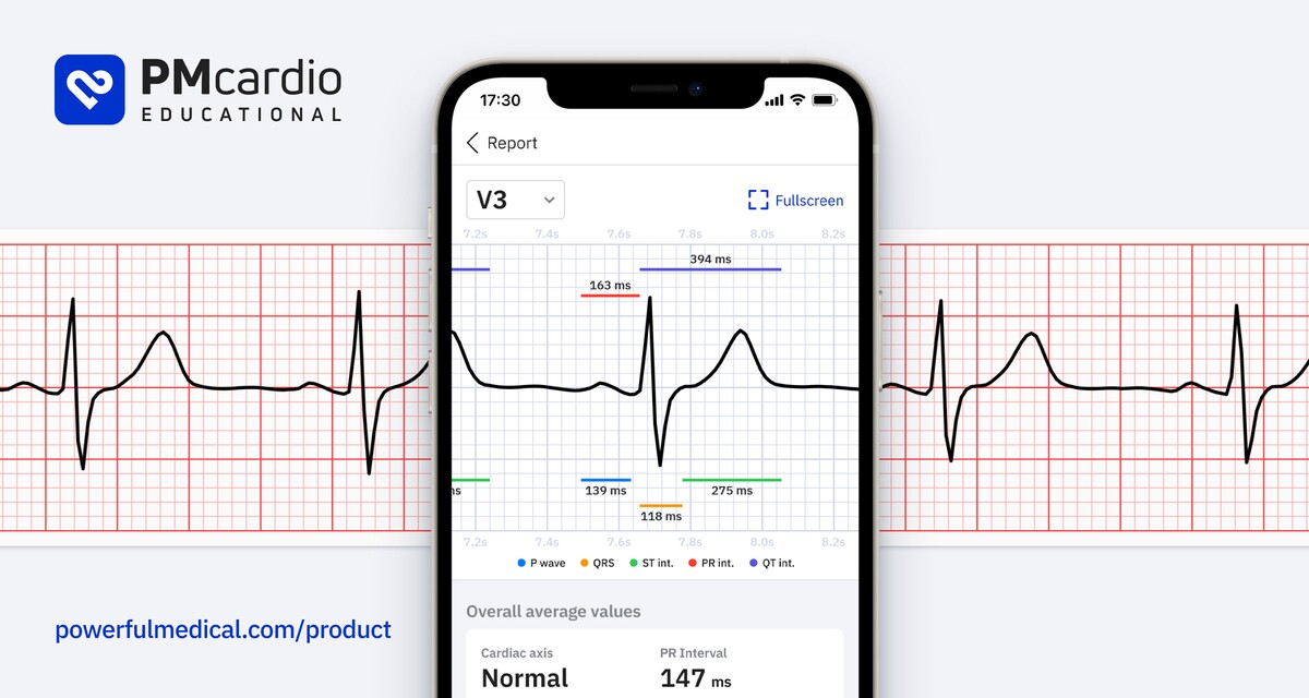 Asistent PMCardio od Powerful Medical.