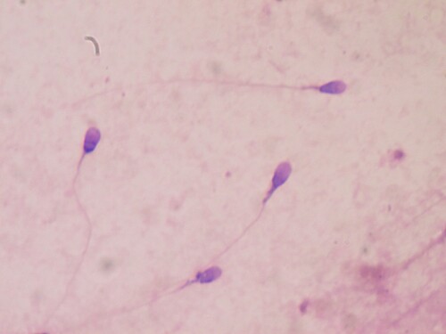 Nejmenší buňky v těle muže jsou spermie. Je tento výrok pravdivý?