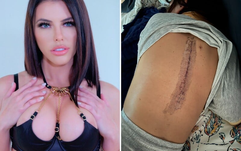 Pornoherečka a streamerka Adriana Chechik si pri bitke v pene škaredo zlomila chrbticu. Pre brutálny úraz prišla o dieťa.