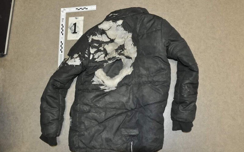 Iba 15-ročný mladík pri Vranove nad Topľou mal podpáliť 11-ročného chlapca. Vraj ho polial horľavinou a zapálil zápalkami.