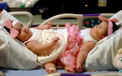 Trojičky mali pozitívny test na koronavírus v deň, keď sa narodili. Nakazila ich matka.
