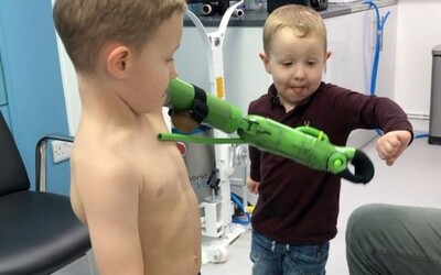 Pětiletý chlapec dostal protézu inspirovanou Hulkem, aby mohl obejmout svého mladšího bratra