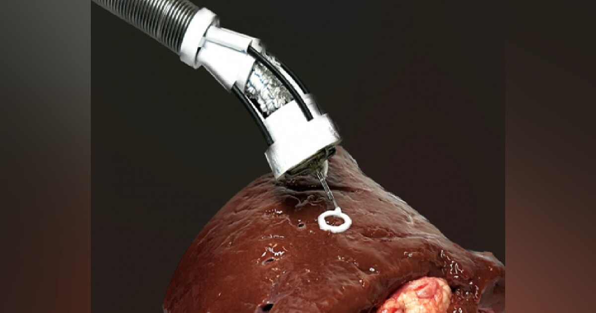 Vědecký tým vyvinul nanoroboty schopné 3D tisku přímo v lidském těle. K čemu je to dobré?