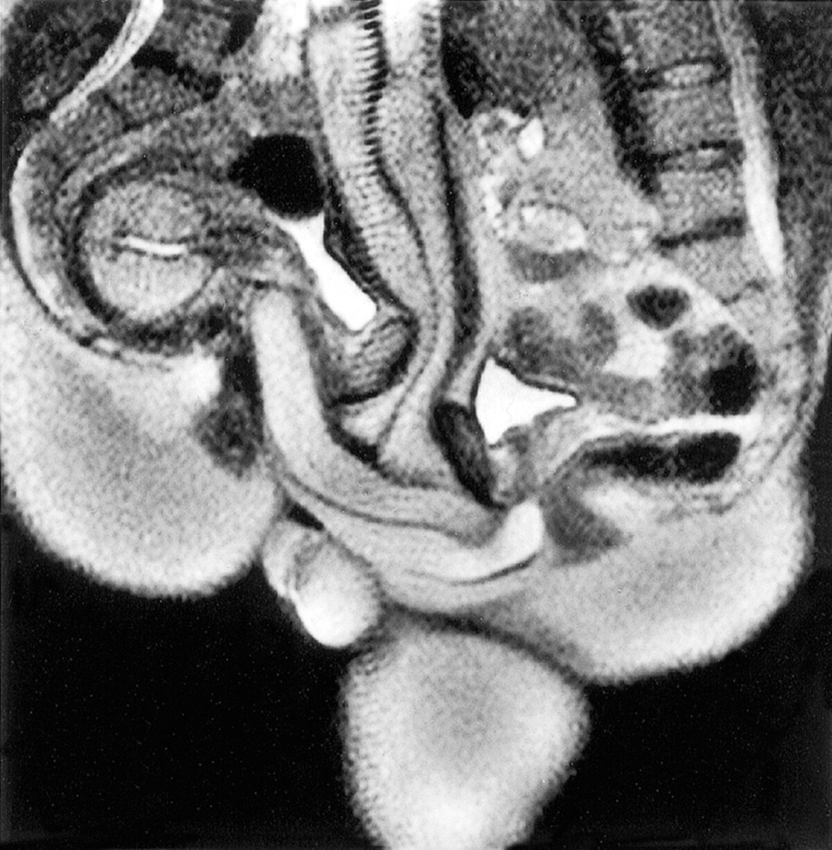 MRI snímka, ktorá prepísala 500 rokov staré vedecké predpoklady.