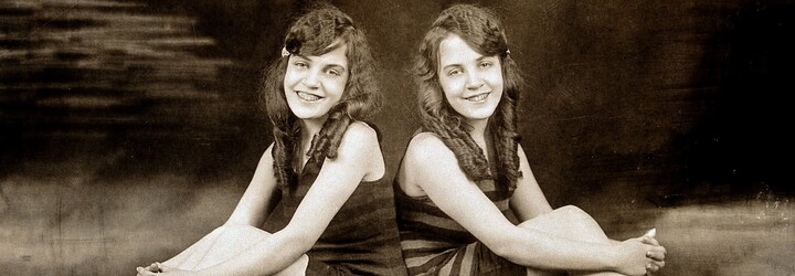 Siamská dvojčata Daisy a Violet Hilton: Dívky byly zneužívány a týrány. V pozdějších letech se provdaly, ale zemřely v zapomnění