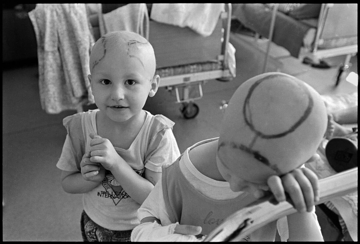 Pětiletá Anya Petrušková, které byl diagnostikován lymfosarkom, stojí za čtyřletým Andrejem Sabirovem z Gomelu, který si 20. srpna 1996 v Gomelské oblastní klinické nemocnici v Bělorusku opírá hlavu o bok postele. Andrejovi byla diagnostikována leukémie. Zpráva OSN z roku 1995 uvádí, že černobylská katastrofa způsobila stoprocentní nárůst výskytu rakoviny a leukémie u dětí. 