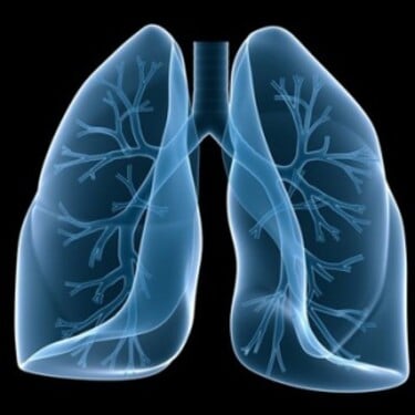 Ktorý faktor sa najviac podieľa na vzniku ochorení pľúc?