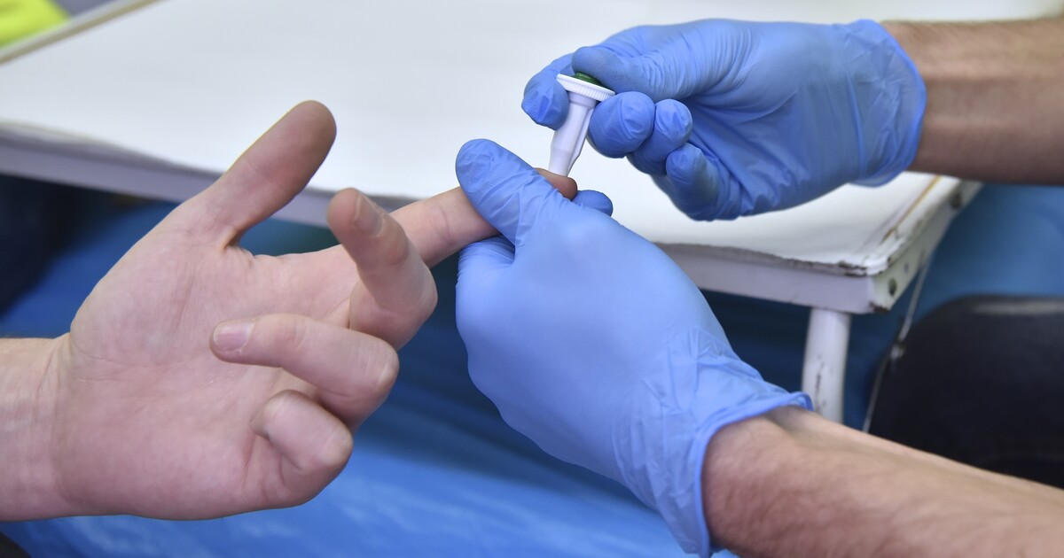 V Česku žije asi 620 lidí, kteří neví o své nákaze HIV. Pomoci by mohl nový plán