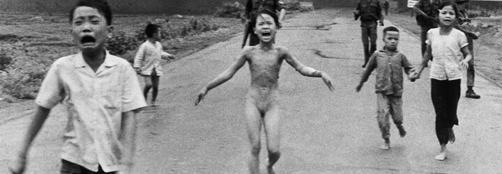 Dívka z ikonické fotky z války ve Vietnamu podstoupila po padesáti letech poslední ošetření kůže