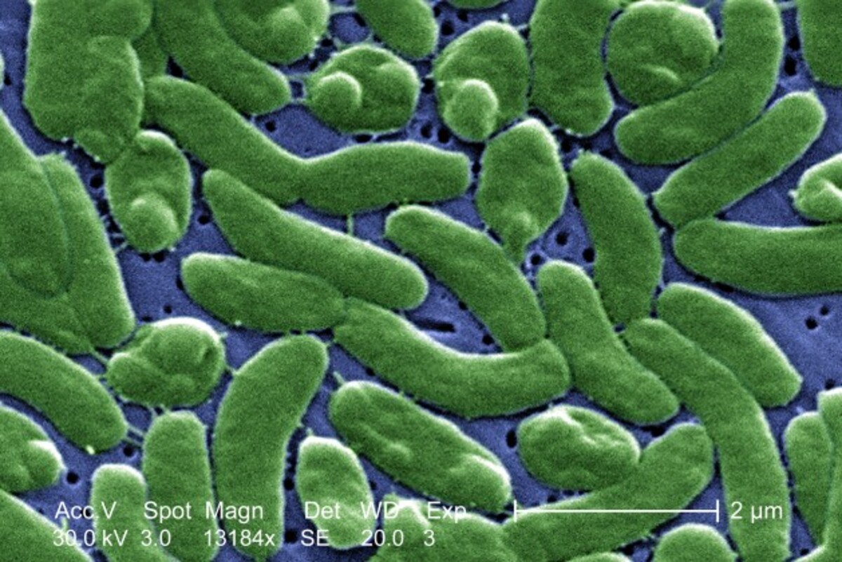 Nebezpečná mäsožravá baktéria Vibrio vulnificus.