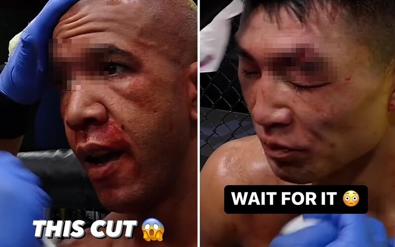 VIDEO: Hrozivé tržné rány na turnaji UFC. Fanoušci MMA se stali svědky děsivých zranění.