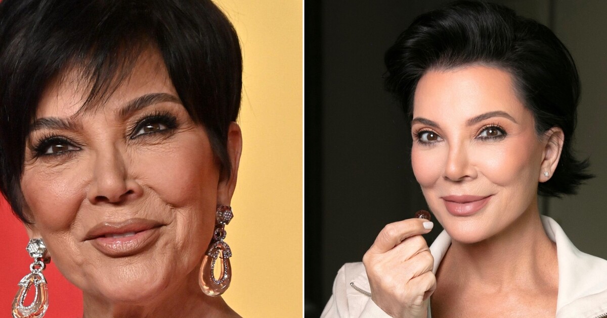 KOMENTÁŘ: Kris Jenner a její virální facelift. Proč umíme omladit o dekády, ale já stále musím protrpět PMS?