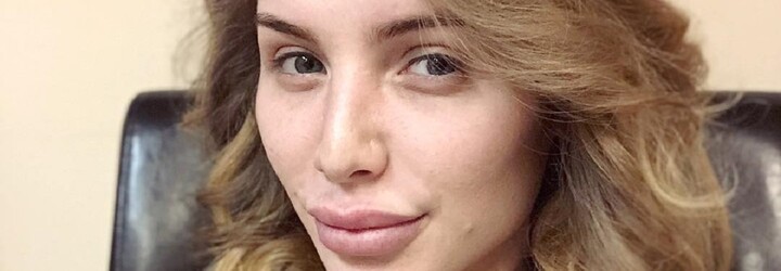 Chtěl se podobat na Kylie Jenner, za plastické operace utratil už více než 2 miliony korun