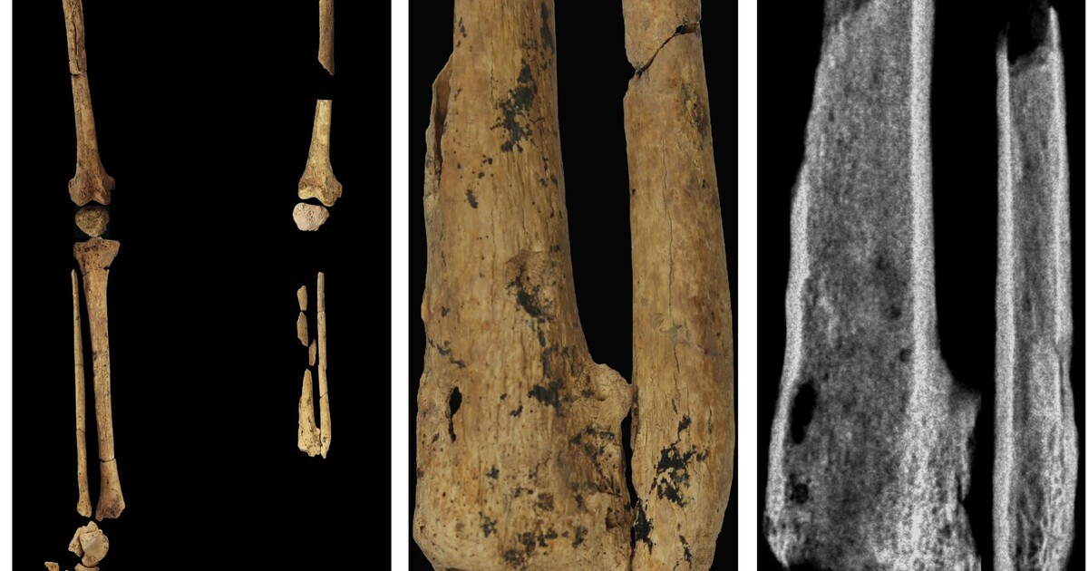 Hrůzný nález při rekonstrukci domu. Muže v Přerově čekalo pod betonovou podlahou sto let staré překvapení
