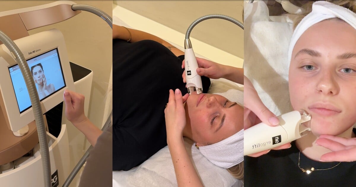 Vyzkoušela jsem LPG Face na dvojitou bradu. Funguje to?