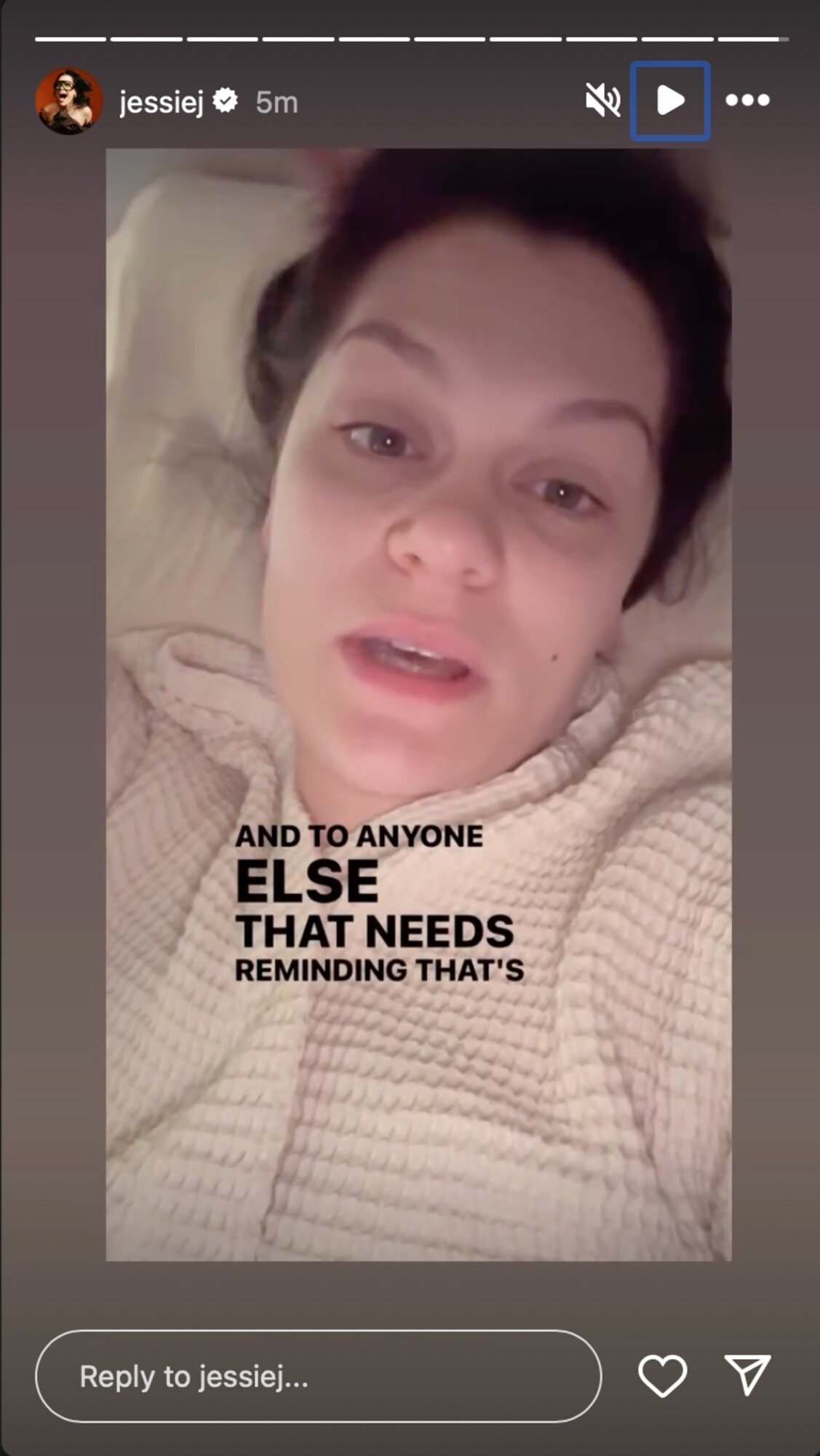 jessie j