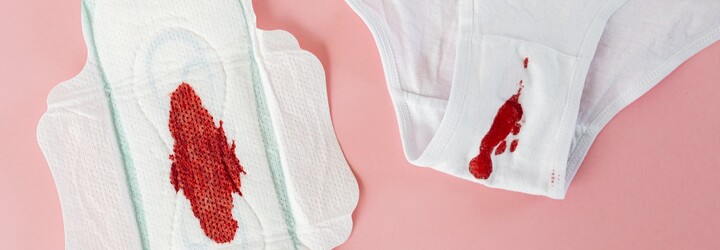 Skotsko: Úředník pro důstojnou menstruaci je cis muž. To je snad vtip, říkají ti, kteří skutečně menstruují